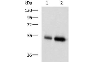 Western blot analysis of Human placenta tissue and Human right lower lung tissue lysates using BMP5 Polyclonal Antibody at dilution of 1:450