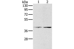 Western Blot analysis of Hela and lovo cell using PDGFRL Polyclonal Antibody at dilution of 1:400 (PDGFRL anticorps)