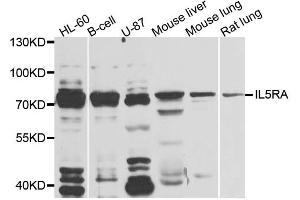 Western blot analysis of extracts of various cell lines, using IL5RA antibody. (IL5RA anticorps)