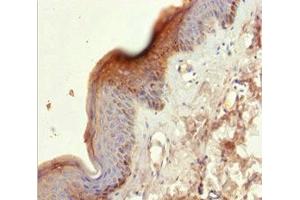 Immunohistochemistry of paraffin-embedded human skin tissue using ABIN7157440 at dilution of 1:100 (KRT6A anticorps  (AA 305-564))