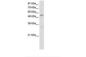 Image no. 3 for anti-DEAD (Asp-Glu-Ala-As) Box Polypeptide 19B (DDX19B) (N-Term) antibody (ABIN203176)