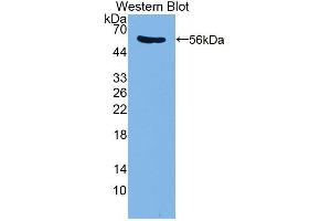 Western blot analysis of the recombinant protein. (PDE4D anticorps  (AA 581-809))