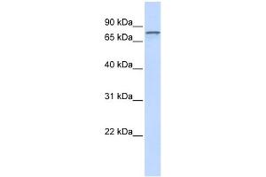 ADAM15 antibody used at 1 ug/ml to detect target protein.