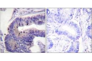 Immunohistochemistry (IHC) image for anti-phosphodiesterase 4D, cAMP-Specific (PDE4D) (AA 156-205) antibody (ABIN2888689) (PDE4D anticorps  (AA 156-205))