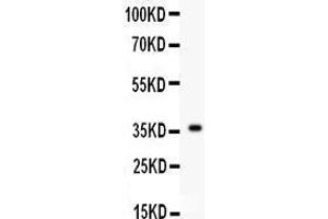 Western Blotting (WB) image for anti-Fibroblast Growth Factor 1 (Acidic) (FGF1) (AA 22-146) antibody (ABIN3042389) (FGF1 anticorps  (AA 22-146))