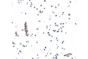 Immunocytochemistry (ICC) image for anti-Platelet Derived Growth Factor Receptor alpha (PDGFRA) (AA 24-525) antibody (ABIN7453344)