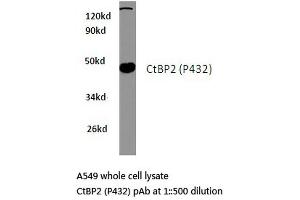 Western blot (WB) analysis of CtBP2 antibody in extracts from A549 cells. (CTBP2 anticorps)