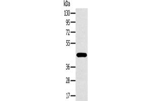 Western Blotting (WB) image for anti-Melanoma Antigen Family A, 10 (MAGEA10) antibody (ABIN2423753) (MAGEA10 anticorps)