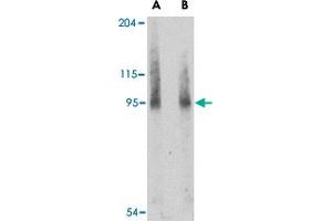 Western blot analysis of BICD2 in A-549 cell lysate with BICD2 polyclonal antibody  at (A) 1 and (B) 2 ug/mL . (BICD2 anticorps  (Internal Region))