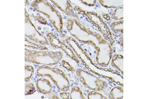 Immunohistochemistry of paraffin-embedded rat kidney using P4HB antibody (ABIN6134876 and ABIN6145140) at dilution of 1:150 (40x lens). (P4HB anticorps)