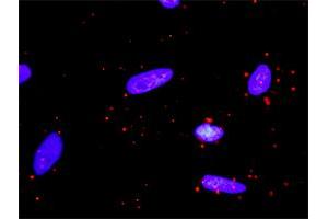 Proximity Ligation Analysis of protein-protein interactions between PIK3R1 and CSF1R. (CSF1R anticorps  (AA 21-120))