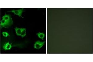 Immunofluorescence analysis of COS7 cells, using CYSLTR1 Antibody.