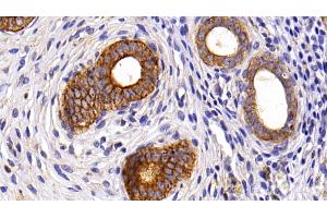 Detection of KRT6A in Rat Uterus Tissue using Polyclonal Antibody to Keratin 6A (KRT6A)