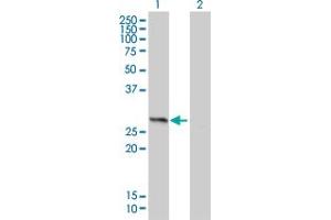 Western Blot analysis of HMGB1 expression in transfected 293T cell line by HMGB1 monoclonal antibody (M01), clone 1E6-E10. (HMGB1 anticorps  (AA 1-215))