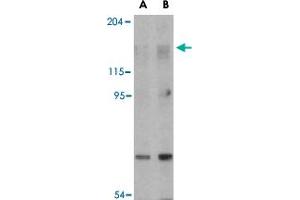 Western blot analysis of RPTOR in L1210 cell lysate with RPTOR polyclonal antibody  at (A) 2 and (B) 4 ug/mL . (Raptor anticorps  (N-Term))