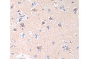 Used in DAB staining on fromalin fixed paraffin- embedded brain tissue