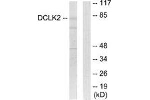 Western Blotting (WB) image for anti-Doublecortin-Like Kinase 2 (DCLK2) (AA 1-50) antibody (ABIN2889673) (DCLK2 anticorps  (AA 1-50))