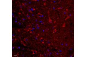 Immunofluorescence of paraffin embedded rat substantia nigra using VIRL2 (ABIN7076206) at dilution of 1: 700 (400x lens) (VN1R2 anticorps)