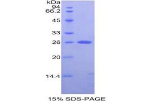 SDS-PAGE analysis of Rat APC Protein.