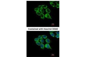 ICC/IF Image Immunofluorescence analysis of methanol-fixed HCT116, using C1r, antibody at 1:500 dilution. (C1R anticorps)