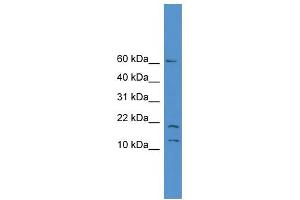 WB Suggested Anti-SNAPC5 Antibody Titration: 0. (SNAPC5 anticorps  (N-Term))