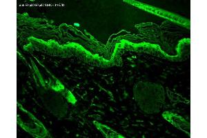 Immunohistochemistry analysis using Mouse Anti-Hsp27 Monoclonal Antibody, Clone 8A7 .