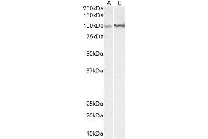 Western Blotting (WB) image for anti-Actinin, alpha 1 (ACTN1) (AA 596-609) antibody (ABIN5857549) (ACTN1 anticorps  (AA 596-609))