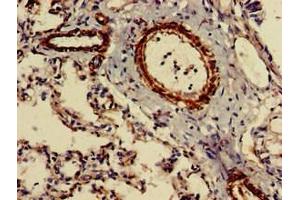 Immunohistochemistry of paraffin-embedded human lung tissue using ABIN7147277 at dilution of 1:100 (CIDEB anticorps  (AA 80-145))