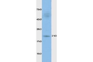 Rat brain lysates probed with Anti DHFR Polyclonal Antibody, Unconjugated (ABIN1387277) at 1:200 in 4 °C.