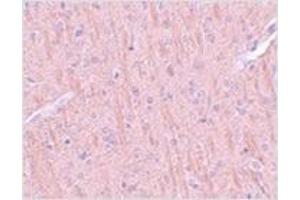 Immunohistochemistry of CCDC106 in rat brain tissue with CCDC106 antibody at 5 μg/ml. (CCDC106 anticorps  (C-Term))