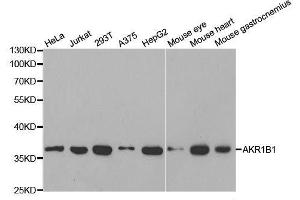 Western blot analysis of extracts of various cell lines, using AKR1B1 antibody.