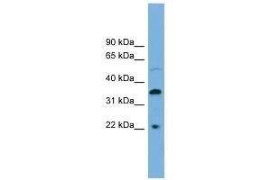 DOK6 antibody used at 1 ug/ml to detect target protein. (DOK6 anticorps  (Middle Region))