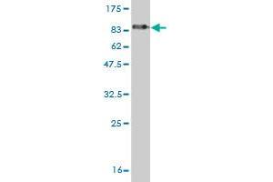 Western Blot detection against Immunogen (81. (EDC3 anticorps  (AA 1-508))