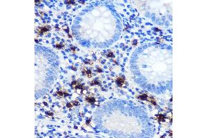 Immunohistochemistry of paraffin-embedded human appendix using Mast Cell Chymase (CM) (CM) Rabbit mAb (1480) at dilution of 1:100 (40x lens). (CMA1 anticorps)