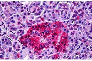 Human Pancreas: Formalin-Fixed, Paraffin-Embedded (FFPE) (NTSR1 anticorps  (AA 181-230))