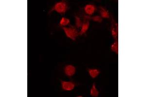 ABIN6272298 staining COLO205 by IF/ICC. (FUBP3 anticorps  (Internal Region))