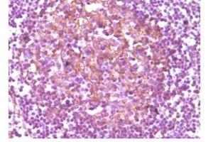 Immunohistochemical analysis of paraffin-embedded human lymphnode, showing membrane localization using CD14 antibody with DAB staining. (CD14 anticorps)