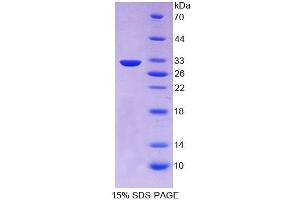 SDS-PAGE (SDS) image for Proprotein Convertase Subtilisin/kexin Type 1 (PCSK1) (AA 500-738) protein (His tag) (ABIN4990183)