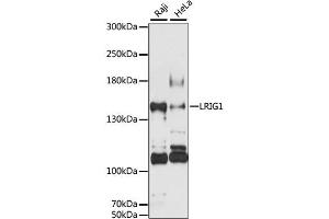 Western blot analysis of extracts of various cell lines, using LRIG1 antibody (ABIN6293213) at 1:3000 dilution. (Lrig1 anticorps)