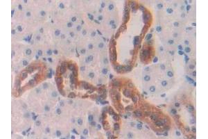 Detection of CTSD in Rat Kidney Tissue using Polyclonal Antibody to Cathepsin D (CTSD) (Cathepsin D anticorps  (AA 120-407))