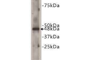 Western Blotting (WB) image for anti-Cadherin EGF LAG Seven Pass G-Type Receptor 2 (CELSR2) antibody (ABIN1854843) (CELSR2 anticorps)
