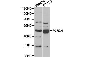 Western blot analysis of extracts of various cell lines, using P2RX4 antibody (ABIN5974027) at 1/1000 dilution. (P2RX4 anticorps)