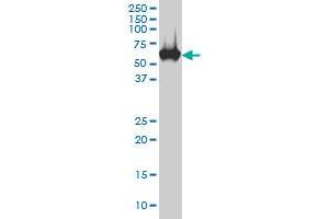 CES2 monoclonal antibody (M02), clone 4F12 Western Blot analysis of CES2 expression in HepG2 .