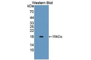 Detection of Recombinant ANG, Human using Polyclonal Antibody to Angiogenin (ANG)