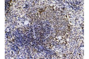 IHC analysis of Cyclophilin A using anti- Cyclophilin A antibody .