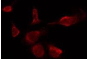 ABIN6277846 staining HepG2 by IF/ICC.