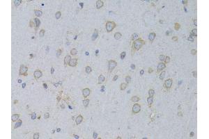 Immunohistochemistry of paraffin-embedded rat brain using GARS antibody.