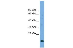 WB Suggested Anti-SLC25A44 Antibody Titration:  0. (SLC25A44 anticorps  (Middle Region))