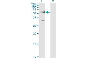 Western Blot analysis of FZD5 expression in transfected 293T cell line by FZD5 monoclonal antibody (M01), clone 6A3.