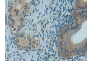 IHC-P analysis of Rat Uterus Tissue, with DAB staining. (TXN anticorps  (AA 1-105))